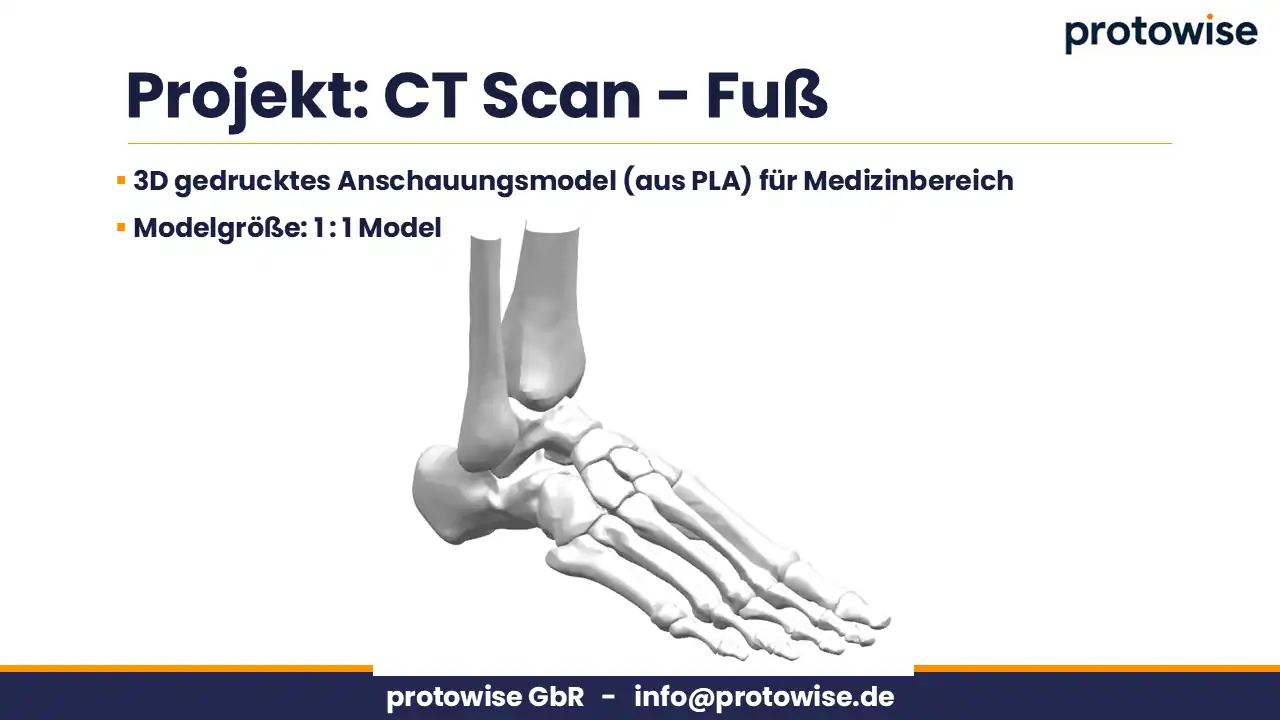 CT_Scan_Fuss