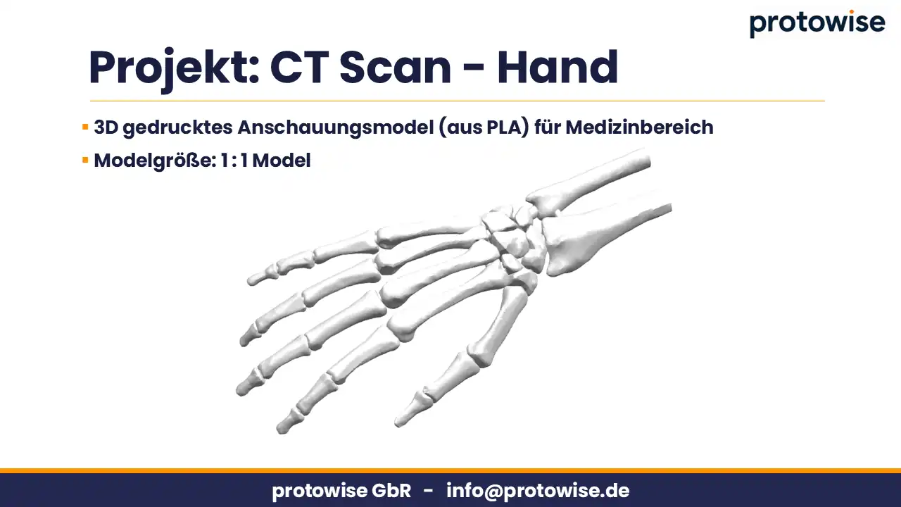 CT_Scan_Hand